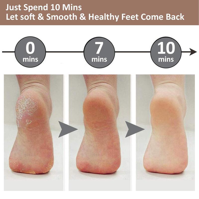Rechargeable Electric Foot Callus Remover,